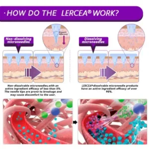 𝑵𝒂𝒏𝒐 𝑴𝒊𝒄𝒓𝒐𝒏𝒆𝒆𝒅𝒍𝒆 𝑺𝒍𝒊𝒎𝒎𝒊𝒏𝒈 𝑷𝒂𝒕𝒄𝒉