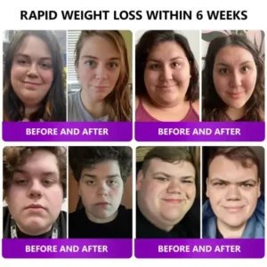 𝑵𝒂𝒏𝒐 𝑴𝒊𝒄𝒓𝒐𝒏𝒆𝒆𝒅𝒍𝒆 𝑺𝒍𝒊𝒎𝒎𝒊𝒏𝒈 𝑷𝒂𝒕𝒄𝒉