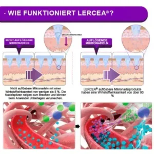 𝑵𝒂𝒏𝒐-𝑴𝒊𝒌𝒓𝒐𝒏𝒂𝒅𝒆𝒍𝒏 𝑺𝒄𝒉𝒍𝒂𝒏𝒌𝒉𝒆𝒊𝒕𝒔𝒑𝒇𝒍𝒂𝒔𝒕𝒆𝒓