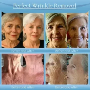 Anti-Wrinkle Skin Cream