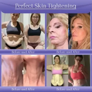 Anti-Wrinkle Skin Cream for Remove Wrinkles