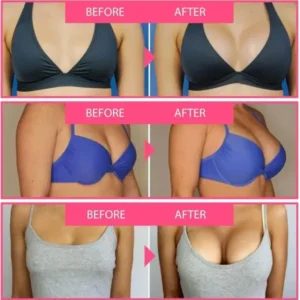 Bee Toxin Lift Cream