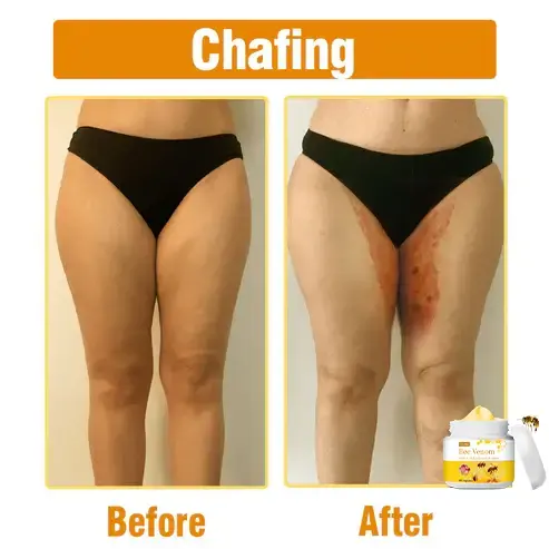 Bee Venom Comprehensive Cream