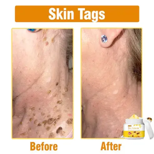 Bee Venom Comprehensive Cream