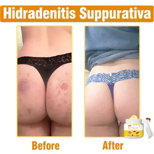 Bee Venom Comprehensive Cream