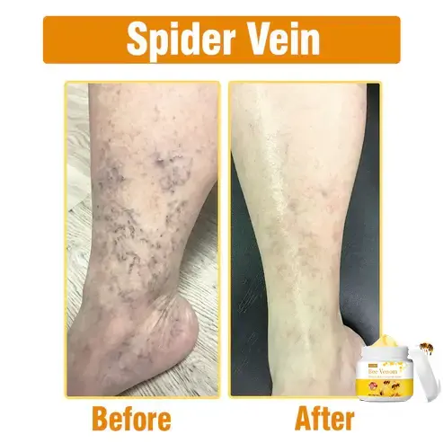 Bee Venom Comprehensive Cream