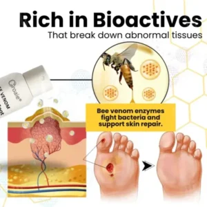 Bee Venom Diabetic Foot Ulcer Spray