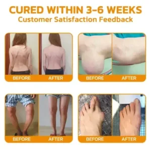 Bee Venom Pain Suppression Joint Healing Cream