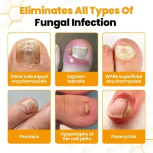 BeeVenom Anti-Fungal Nail Renewal Oil