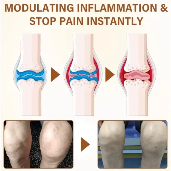 BoomTimilk® MagniBee Vital Joint Comfort Spray