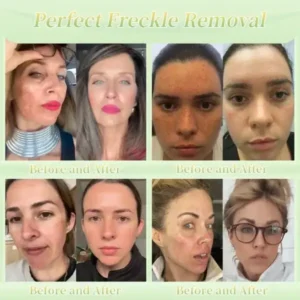 Firming Cream——Visibly Firms in Just 21 Days – Without Surgery or Irritation