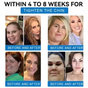 Nano Microneedle Weight Loss Patch