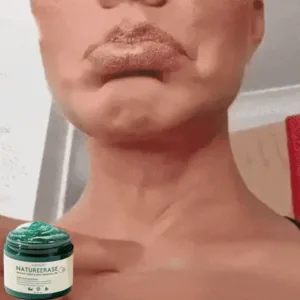 NatureErase Instant Mole & Spot Removal Gel