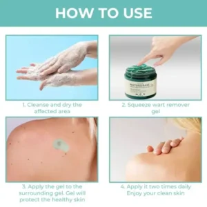 NatureErase Instant Mole & Spot Removal Gel