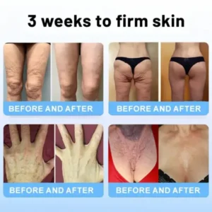 Oligopeptide-Infused Skin Firming Cream