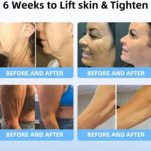 Royal Jelly Moisturizing Lifting Cream