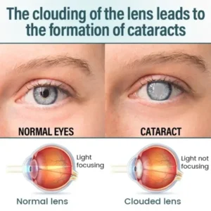 Timilk® OptiFusion Nano Eye Drops Serum