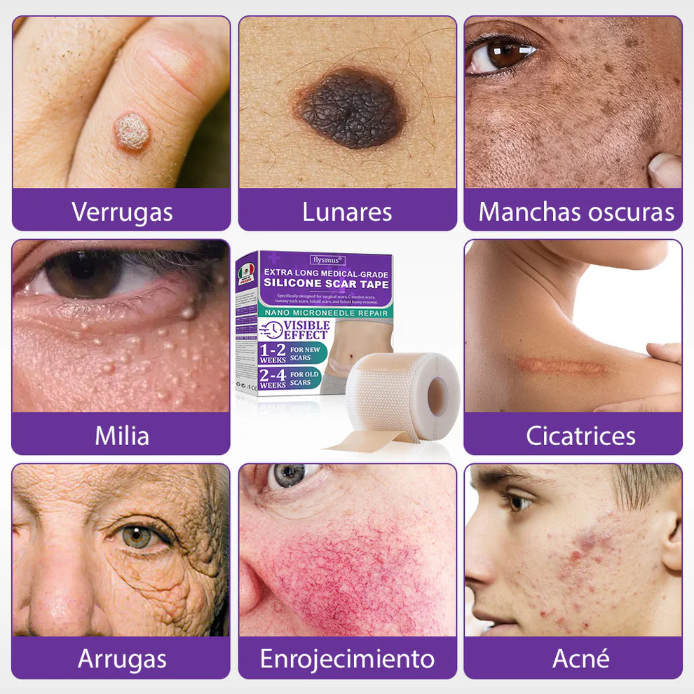 Micronadles con Ácido Hialurónico Nano - Image 11