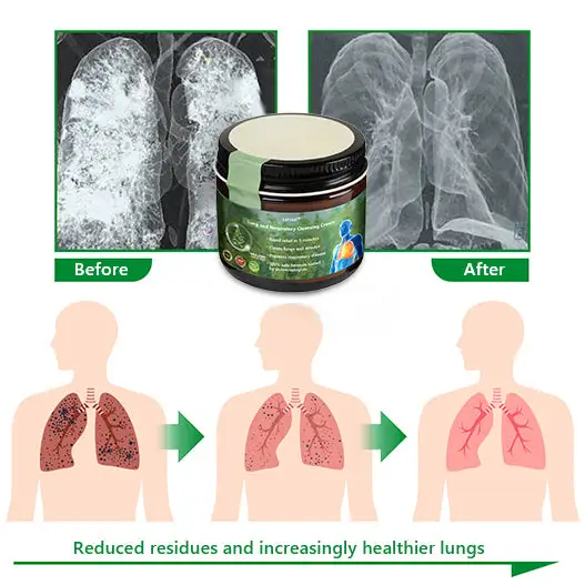 Mullein Clear Lung Repair Cream - Image 11