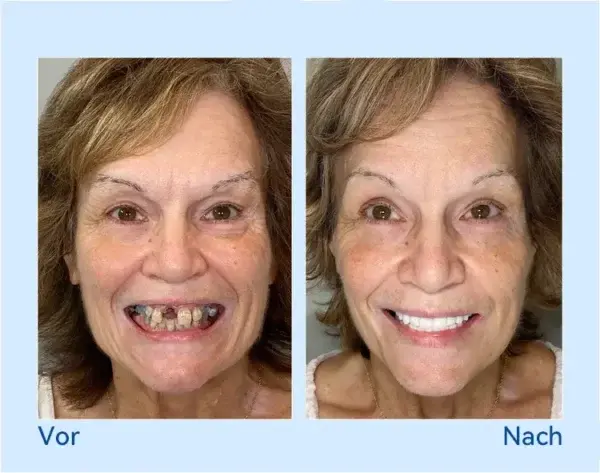 𝐏𝐫𝐞𝐦𝐢𝐮𝐦 𝐆𝐞𝐛𝐢𝐬𝐬🦷 - Image 11