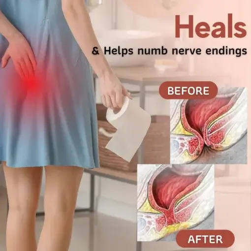 Relief Cream - Image 3