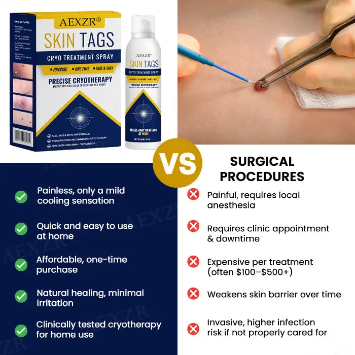 Skin Tag Cryo Treatment Spray - Image 2
