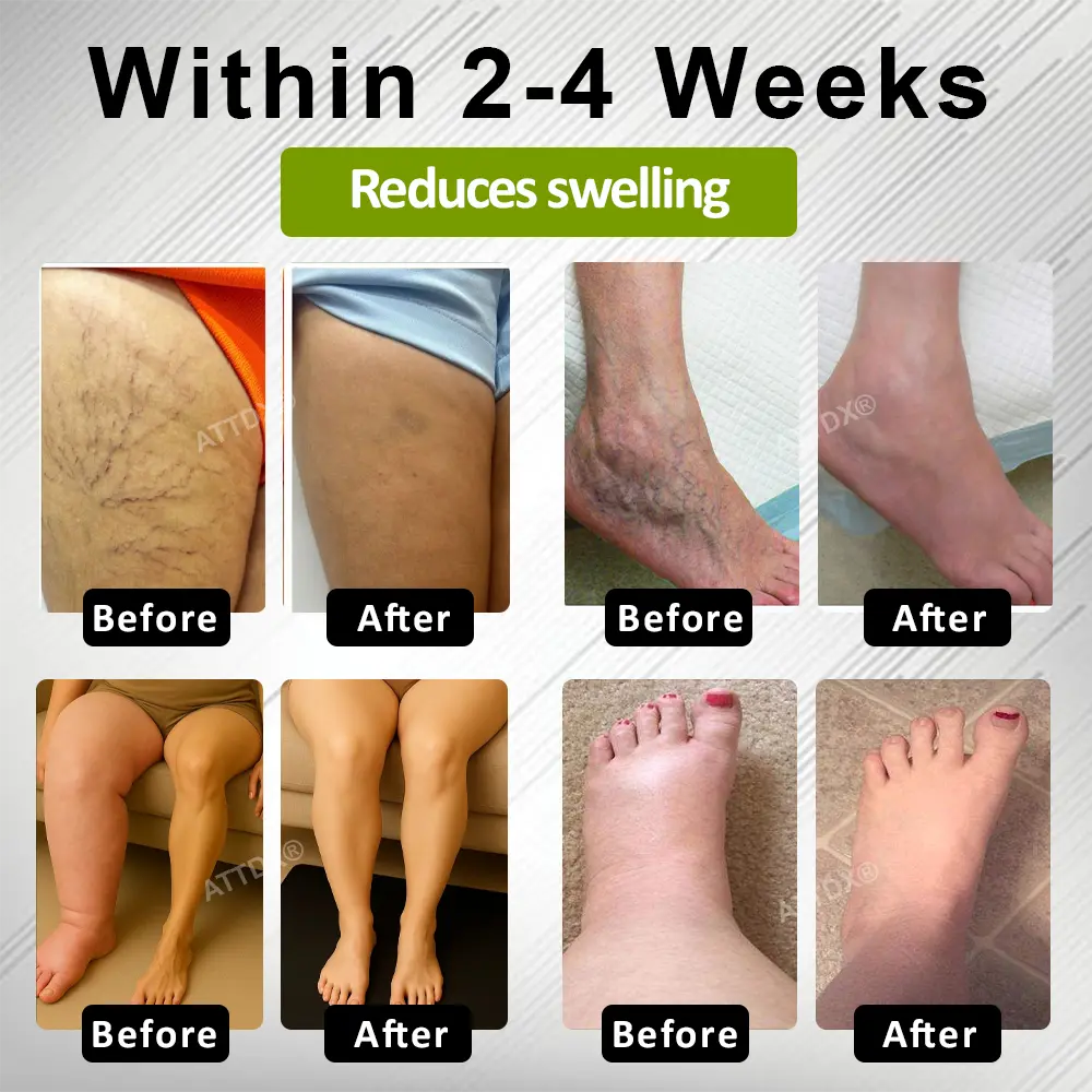 Fluid Regulation Edema Care Cream - Image 6