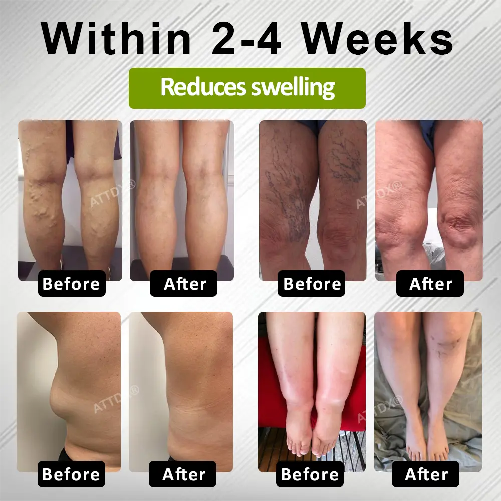 Fluid Regulation Edema Care Cream - Image 7