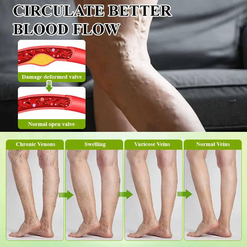 Fluid Regulation Edema Care Cream - Image 8