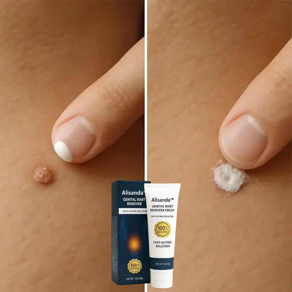 |Genital Warts Remover Cream for Men - Image 17