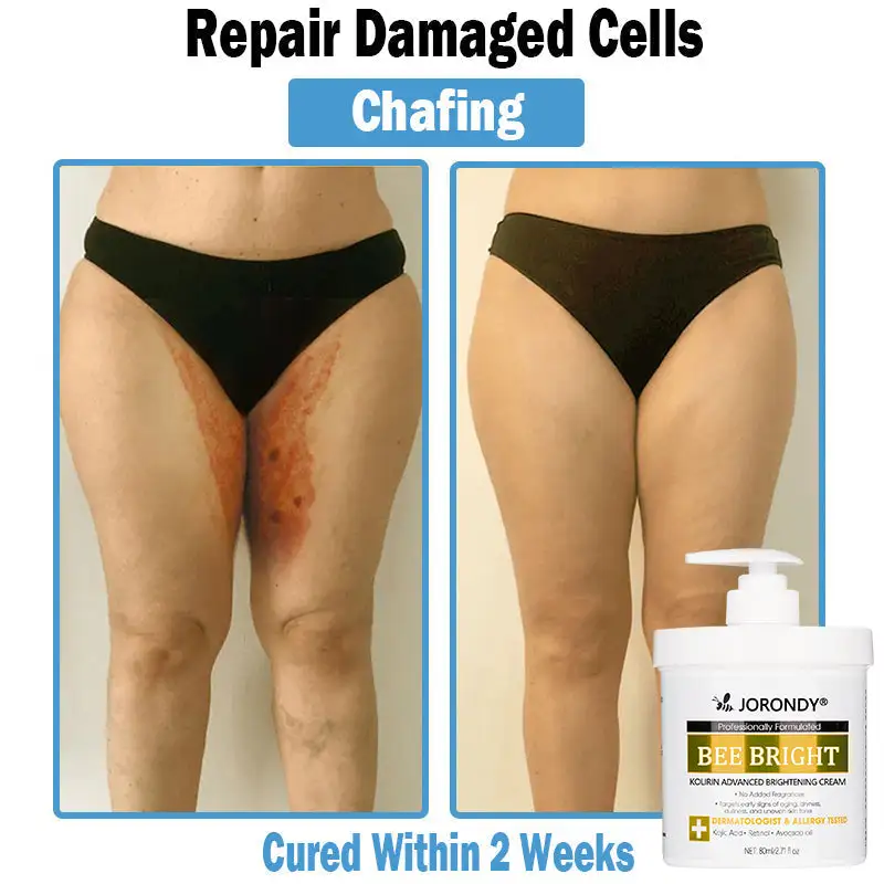 Bee Bright Multi-Symptom Skin Treatment Cream - Image 8