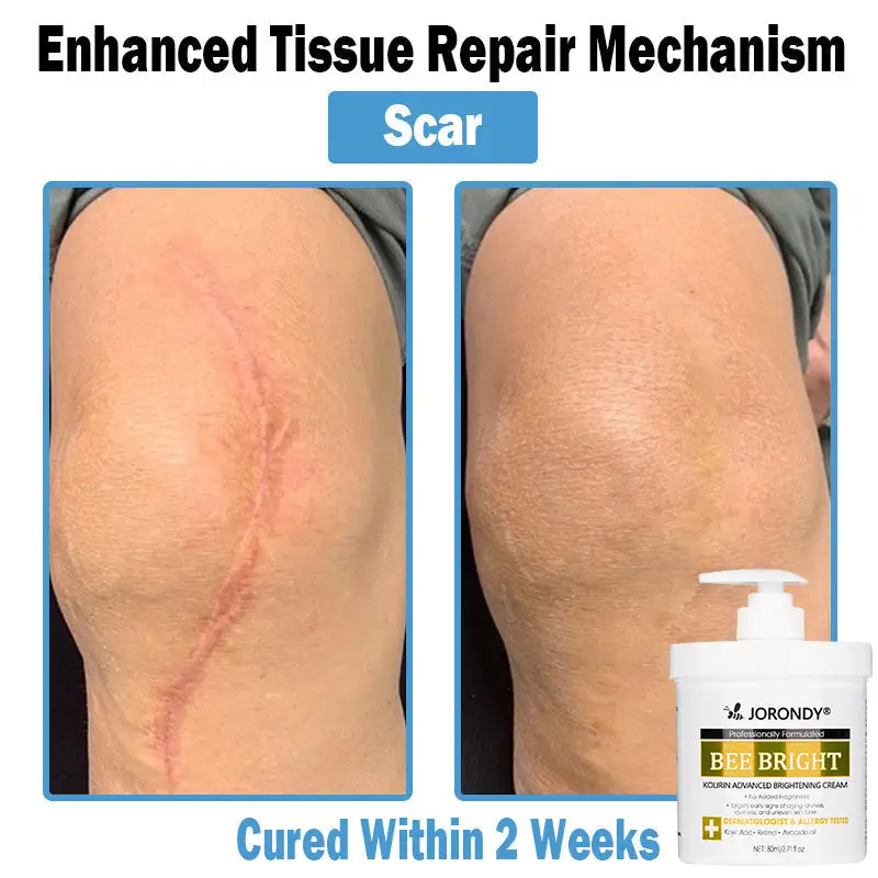 Bee Bright Multi-Symptom Skin Treatment Cream - Image 12