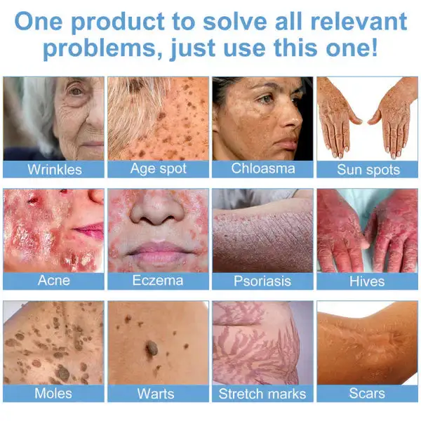 Bee Bright Multi-Symptom Skin Treatment Cream - Image 2