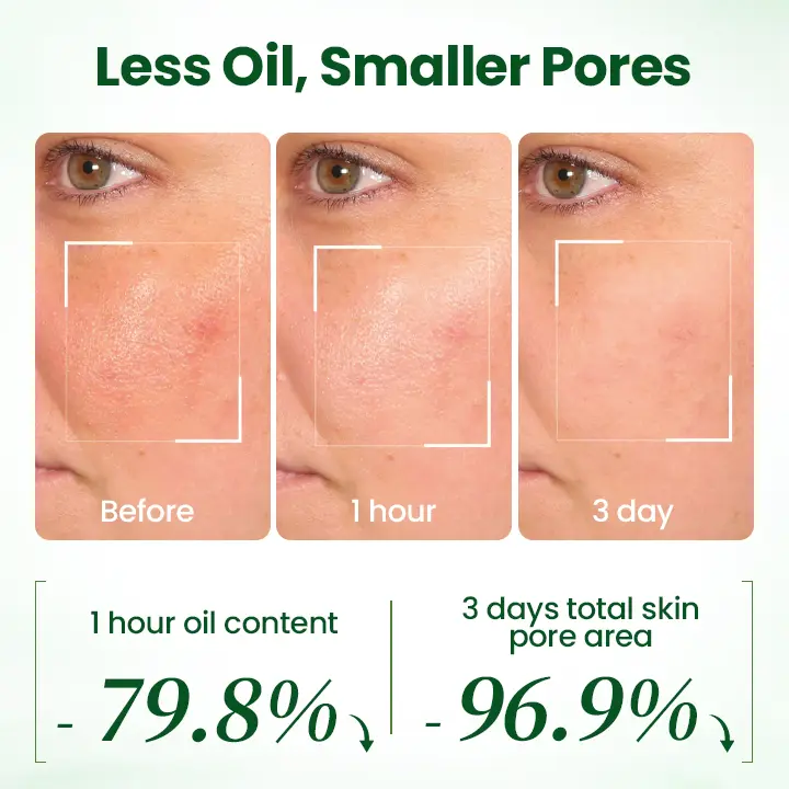 PoreMelt Avocado Acid Mask - Image 2