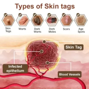 Black Rice Skin Repair Essence Cream