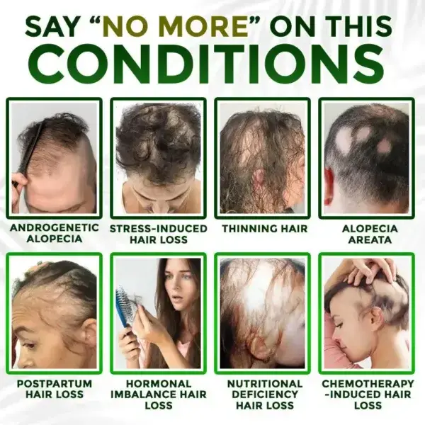 Herbal Infusion Hair Stimulation Set - Image 4