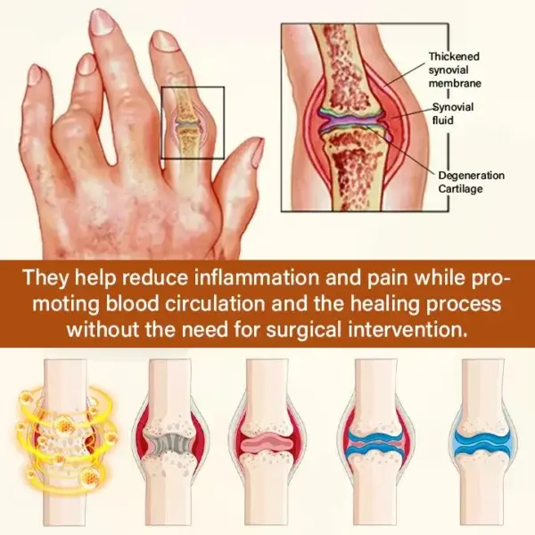 VenomEase Joint Cream - Image 7
