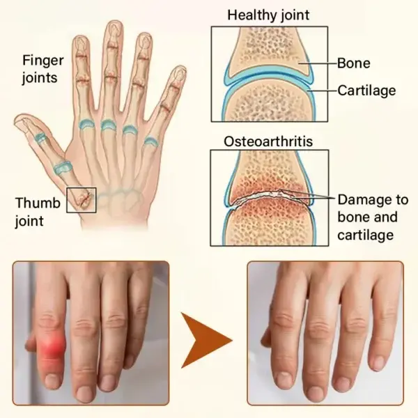 VenomEase Joint Cream - Image 8