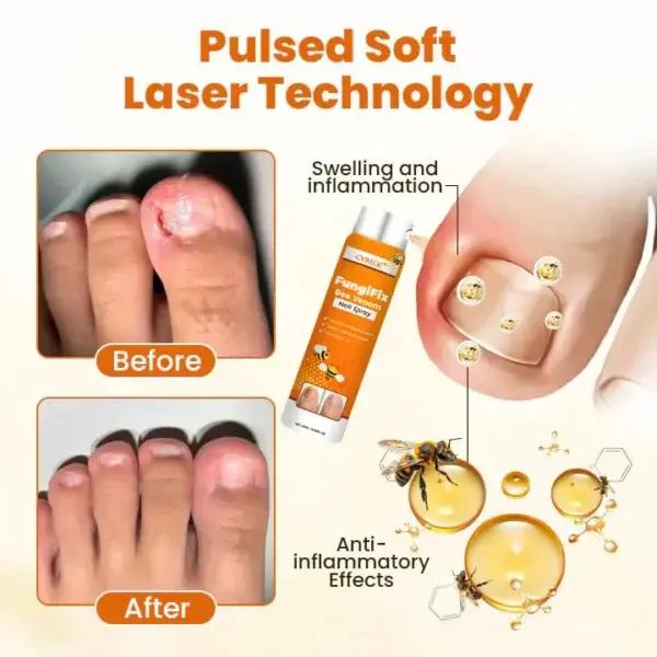 Bee Venom Nail Spray - Image 6