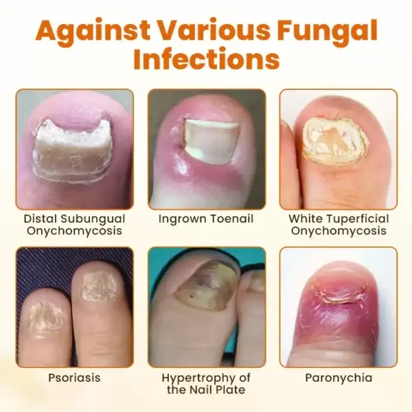 Bee Venom Nail Spray - Image 7