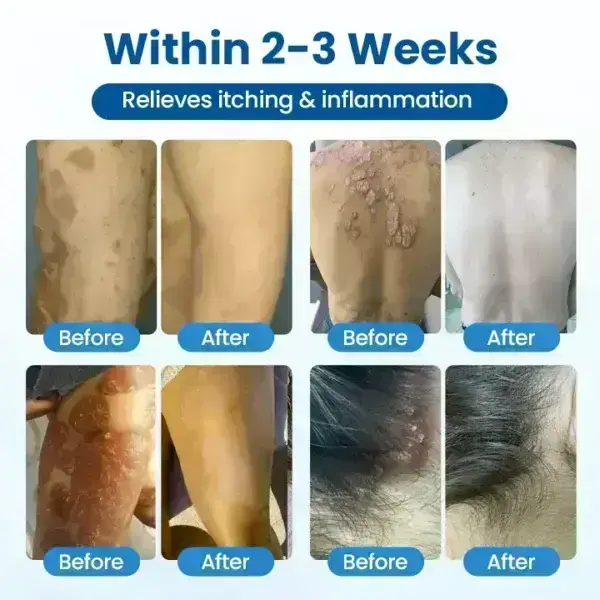 Magnesium Deep Repair Spray - Image 6