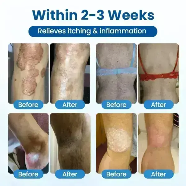 Magnesium Deep Repair Spray - Image 7