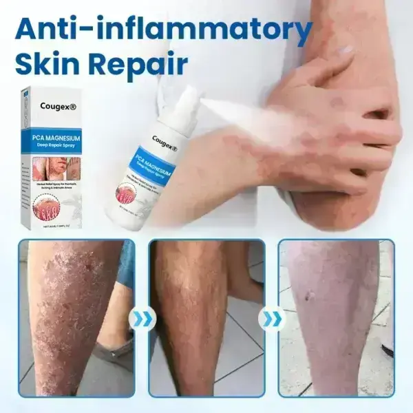 Magnesium Deep Repair Spray - Image 9