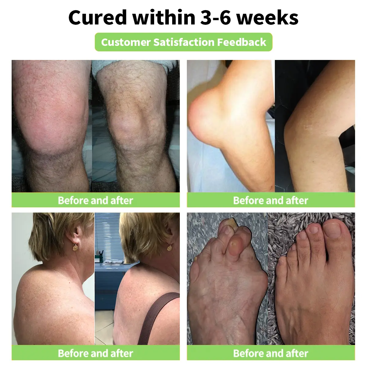 Bee Venom Joint and Bone Therapy Advanced Cream - Image 4