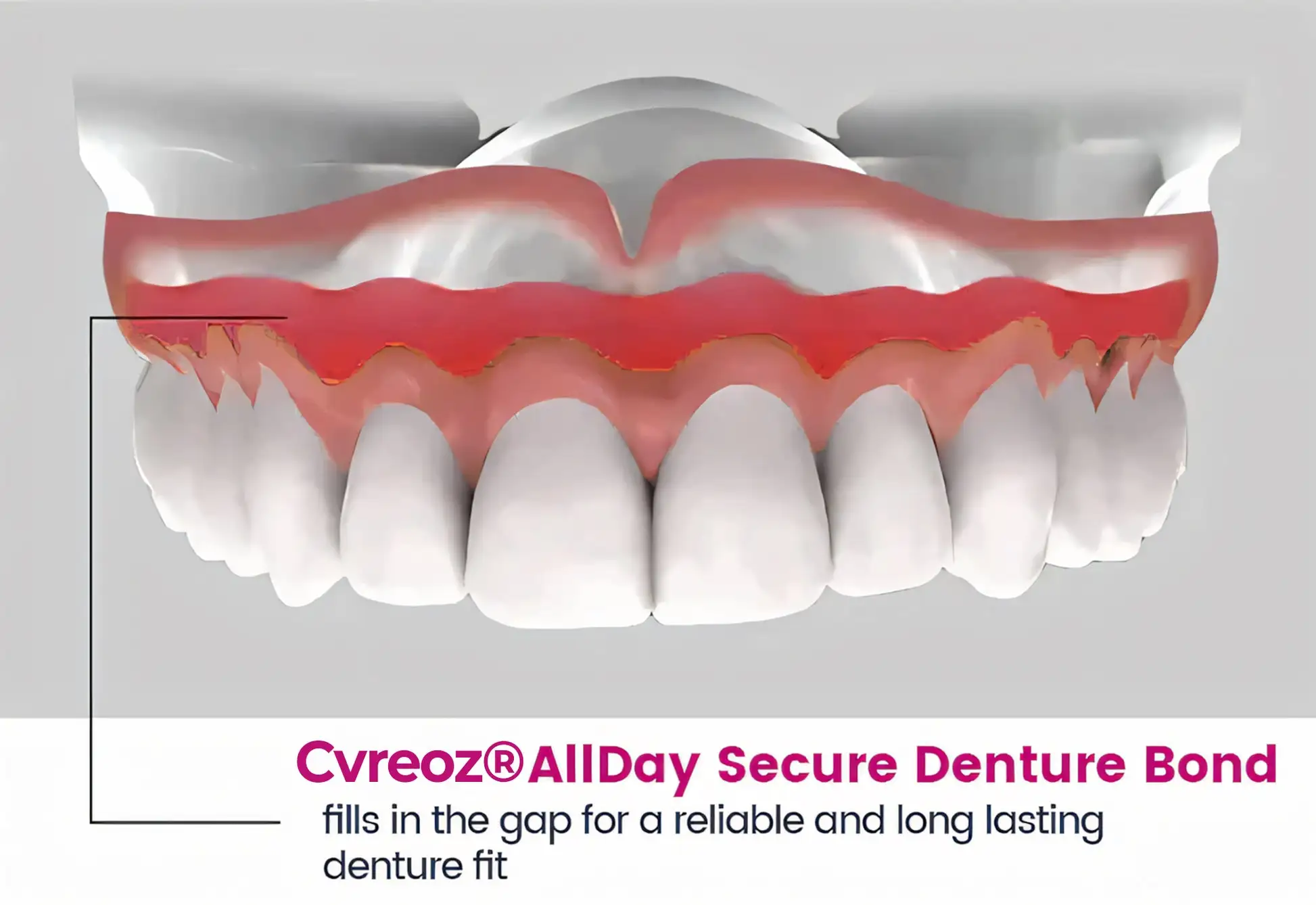 AllDay Secure Denture Bond - Image 7