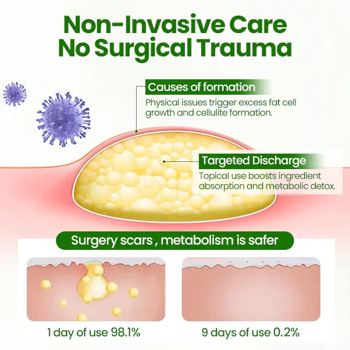 Lipoma Removal Cream - Image 5