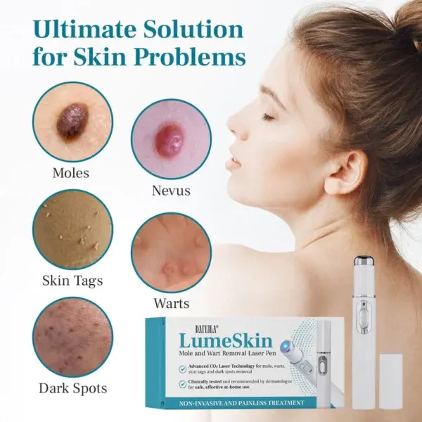 DAFEILA® LumeSkin Mole and Wart Removal Laser Pen - Image 3