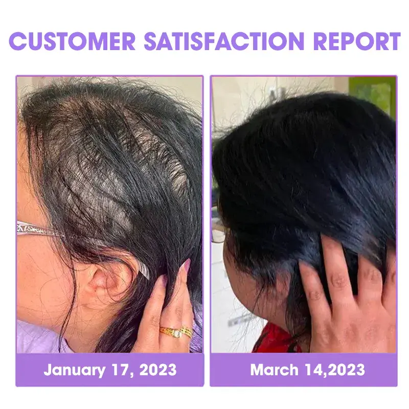 ✨👩🔬 Hair Root Repair Growth Drops - Image 4