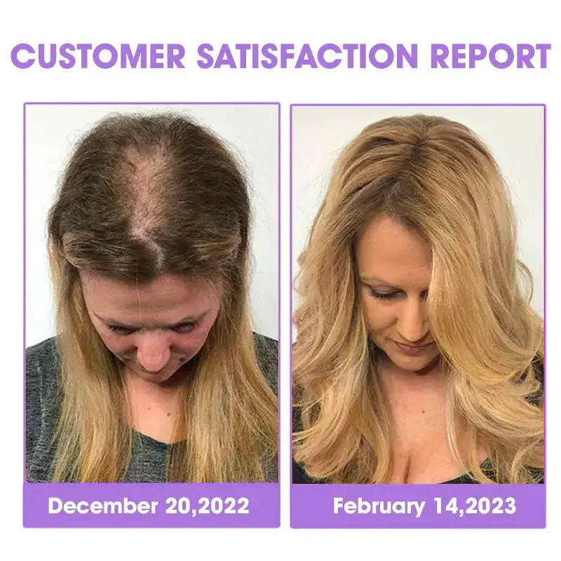 ✨👩🔬 Hair Root Repair Growth Drops - Image 5