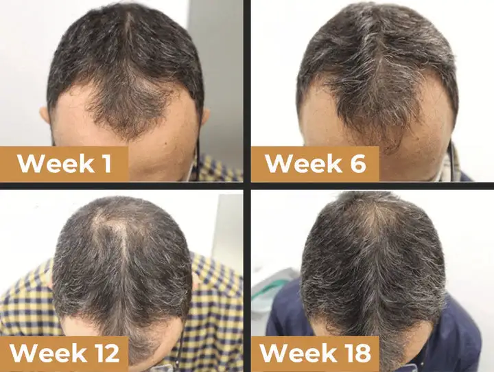 Root Activator Shampoo - Image 4